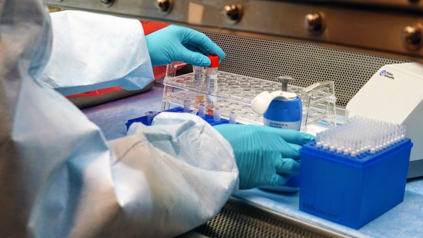 San Francisco Public Health Lab testing for Coronavirus
