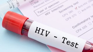 La vacuna busca estimular la producción de anticuerpos capaces de actuar ante distintas variantes del VIH en circulación con una primera dosis y una dosis de refuerzo a través de mRNA.
