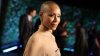 Qué es la alopecia, la condición que padece la esposa del actor Will Smith