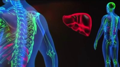 Un experto en nutrición explica cómo puedes limpiar tu hígado para bajar de peso saludablemente