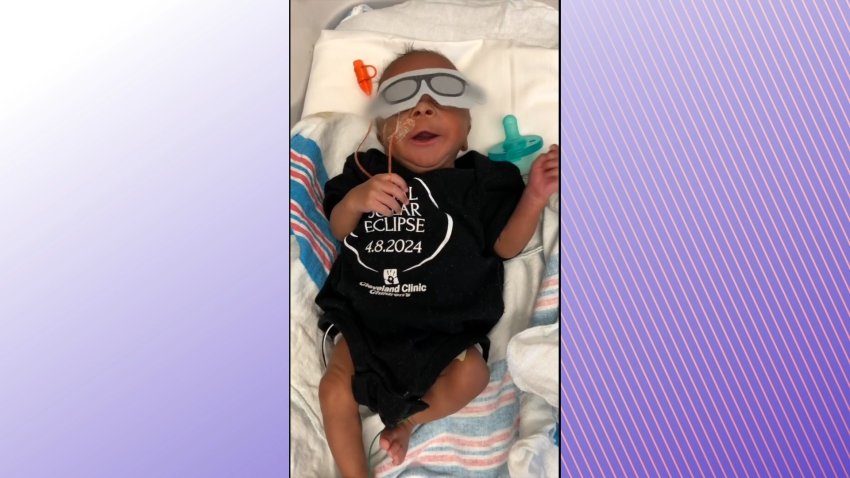 A baby with glasses in the NICU