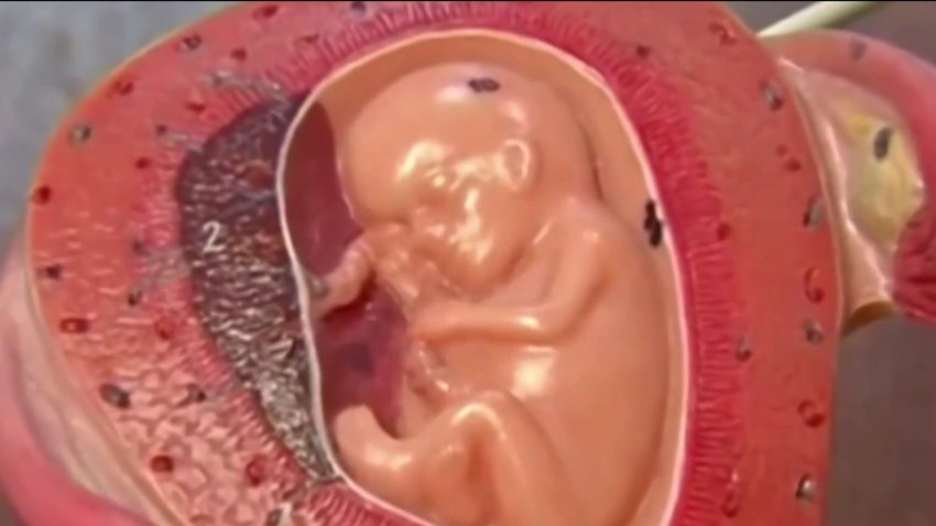 Corte Suprema de Arizona dictamina que se puede hacer cumplir una prohibición casi total del aborto de 1864