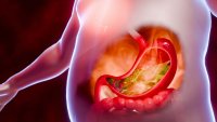 Symptoms of acid reflux or excess acid in the stomach. Gastric juice and intestinal model within the abdominal cavity. Burning sensation in the middle of the chest, acid reflux. 3D Rendering.